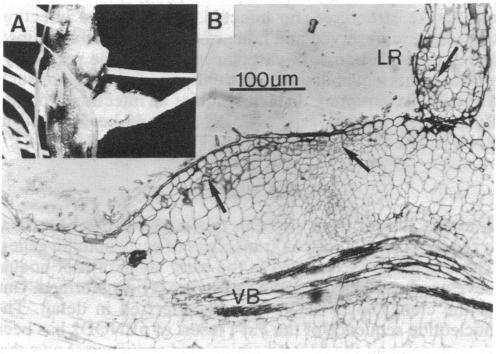 https://cdn.ncbi.nlm.nih.gov/pmc/blobs/18db/305116/c403109526b3/pnas00278-0154-a.jpg
