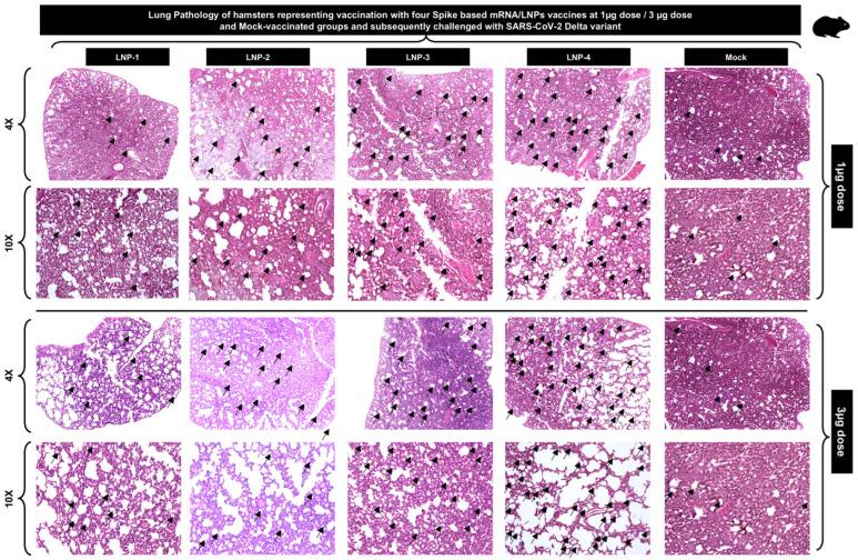 https://cdn.ncbi.nlm.nih.gov/pmc/blobs/18ef/11769137/37e1daa83acb/vaccines-13-00047-g005.jpg
