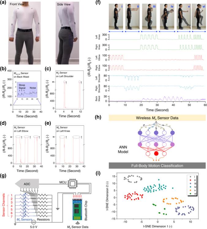 https://cdn.ncbi.nlm.nih.gov/pmc/blobs/18f0/10784403/d3e8b4644159/604_2023_6163_Fig30_HTML.jpg