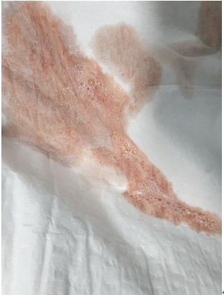 https://cdn.ncbi.nlm.nih.gov/pmc/blobs/18f1/9346198/734e3132890e/apm-21116f2.jpg