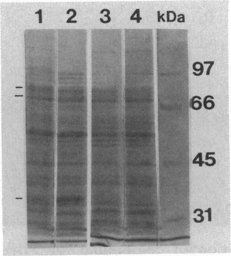 https://cdn.ncbi.nlm.nih.gov/pmc/blobs/18f4/192404/9a9154c7dae8/aac00033-0203-a.jpg