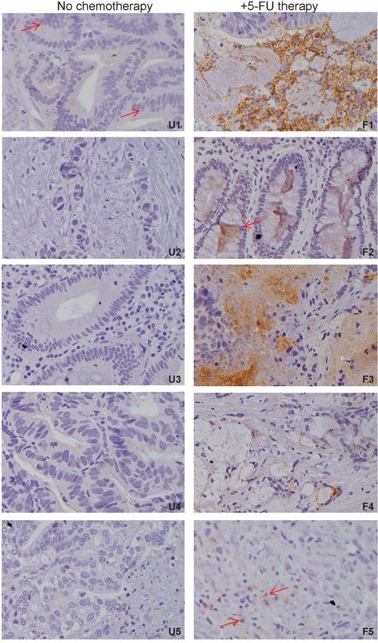 https://cdn.ncbi.nlm.nih.gov/pmc/blobs/18f8/5346671/8b1d23e95d9a/oncotarget-07-78698-g002.jpg