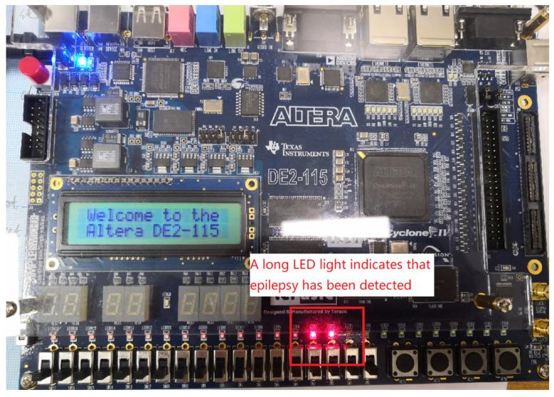 https://cdn.ncbi.nlm.nih.gov/pmc/blobs/18fa/11723055/baf5c319c2f9/sensors-25-00033-g011.jpg