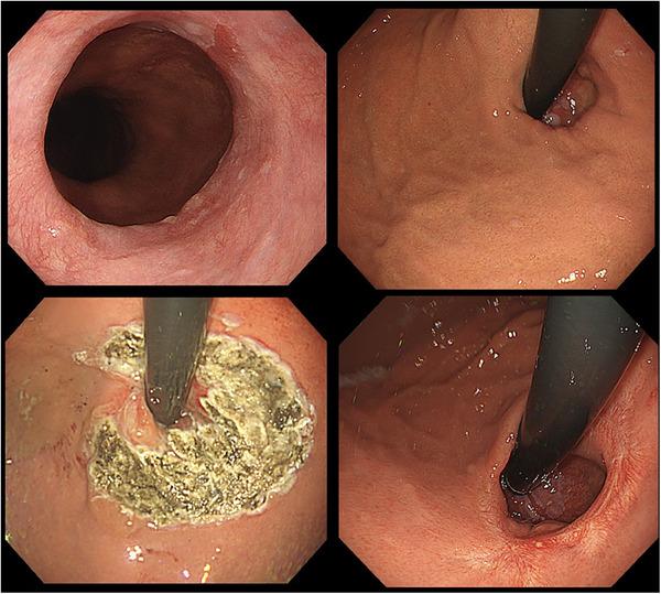 https://cdn.ncbi.nlm.nih.gov/pmc/blobs/18fb/12213444/042042d461cc/DEO2-6-e70169-g001.jpg