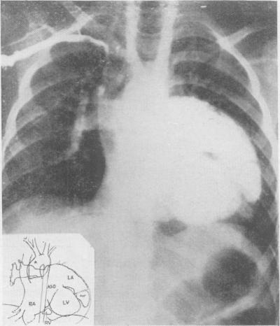 https://cdn.ncbi.nlm.nih.gov/pmc/blobs/1904/2500901/8eb138e4f41a/postmedj00519-0007-a.jpg