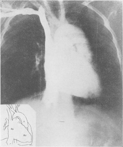 https://cdn.ncbi.nlm.nih.gov/pmc/blobs/1904/2500901/aac854f19ccd/postmedj00519-0006-a.jpg