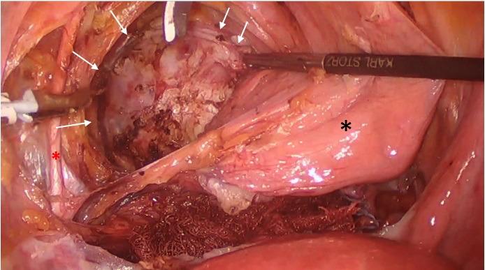 https://cdn.ncbi.nlm.nih.gov/pmc/blobs/1906/10410648/3339c1ddb0db/FVVinObGyn-15-161-g002.jpg