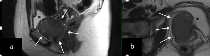 https://cdn.ncbi.nlm.nih.gov/pmc/blobs/1906/10410648/37d45a435d67/FVVinObGyn-15-161-g005.jpg