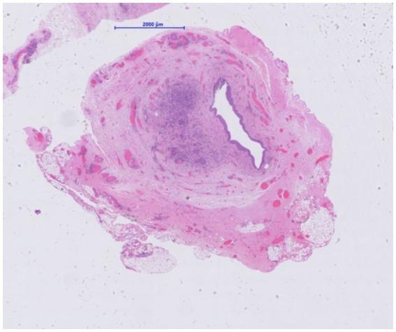 https://cdn.ncbi.nlm.nih.gov/pmc/blobs/1908/11175655/209d4c17ae65/fmed-11-1394028-g003.jpg