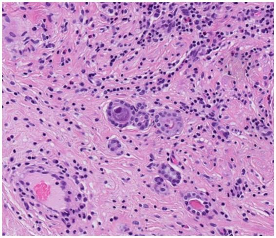 https://cdn.ncbi.nlm.nih.gov/pmc/blobs/1908/11175655/a7b2abc61209/fmed-11-1394028-g004.jpg