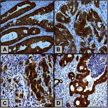 https://cdn.ncbi.nlm.nih.gov/pmc/blobs/1909/4603921/2875775882b0/12885_2015_1662_Fig1_HTML.jpg
