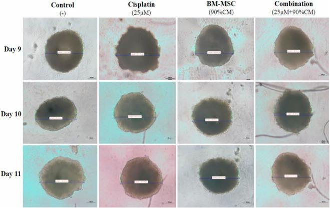 https://cdn.ncbi.nlm.nih.gov/pmc/blobs/190b/12095274/0aad61fbb98a/fcell-13-1521809-g004.jpg