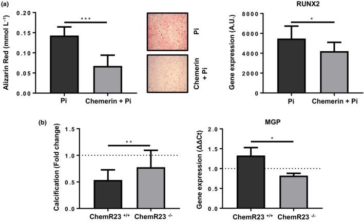 https://cdn.ncbi.nlm.nih.gov/pmc/blobs/190b/6852438/cfc01f554d4c/JOIM-286-449-g004.jpg