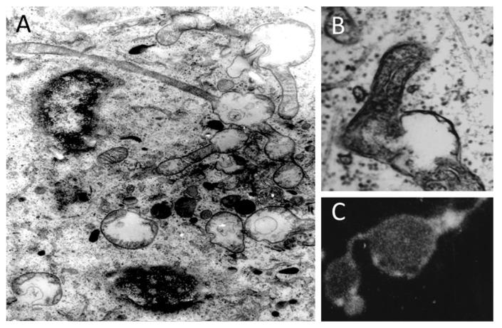 https://cdn.ncbi.nlm.nih.gov/pmc/blobs/190c/6406845/6f63ac299736/cells-08-00175-g008.jpg