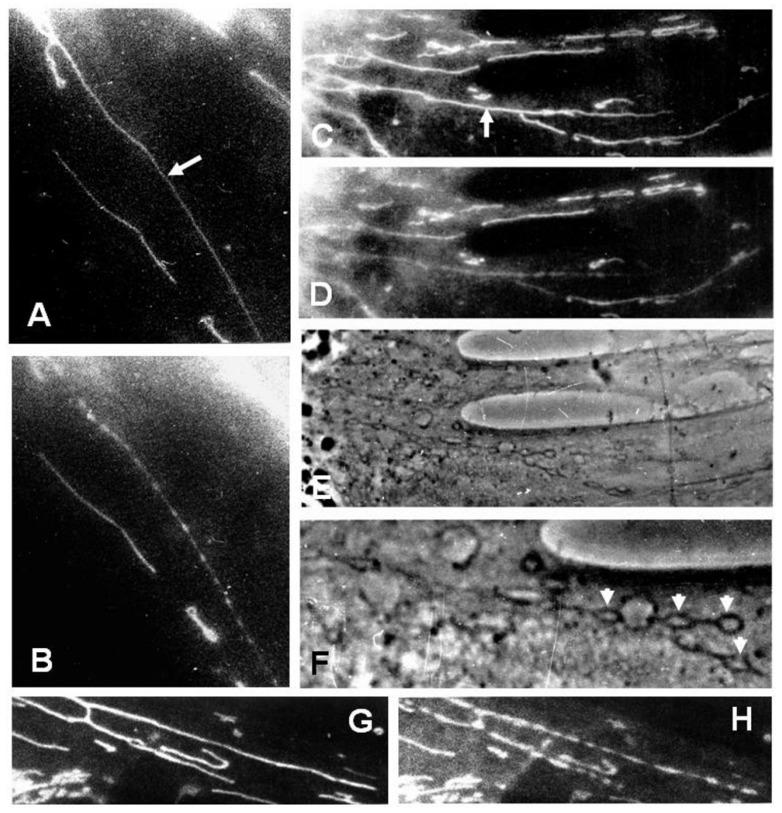 https://cdn.ncbi.nlm.nih.gov/pmc/blobs/190c/6406845/be5bfcfc3e8b/cells-08-00175-g007.jpg