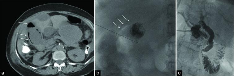 https://cdn.ncbi.nlm.nih.gov/pmc/blobs/190e/7110106/c0606173ca25/JCIS-10-9-g001.jpg