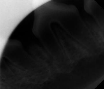 https://cdn.ncbi.nlm.nih.gov/pmc/blobs/1910/10924275/e07f97807a9d/VMS3-10-e1395-g014.jpg