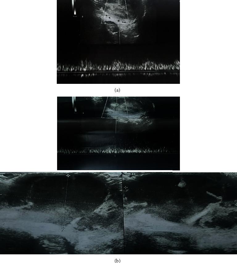 https://cdn.ncbi.nlm.nih.gov/pmc/blobs/1915/9250965/463c97200a90/CRIU2022-1891429.002.jpg