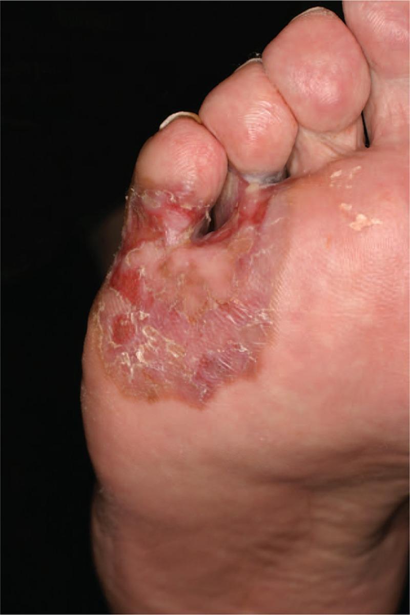 https://cdn.ncbi.nlm.nih.gov/pmc/blobs/1918/5265802/119b2915bf64/medi-95-e4332-g006.jpg