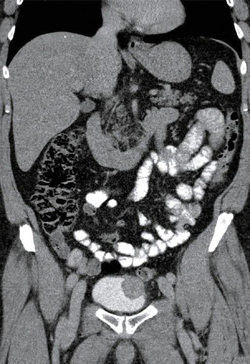 https://cdn.ncbi.nlm.nih.gov/pmc/blobs/1921/12177346/6127a2c94c90/vomt-20-1-17932-g1.jpg