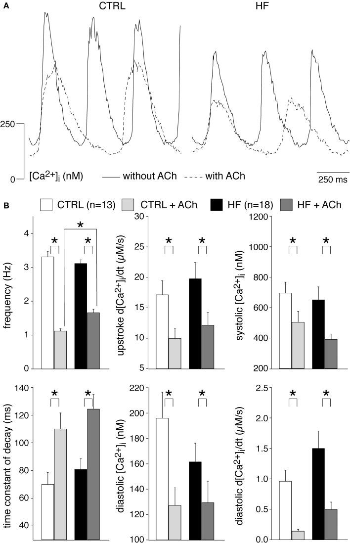 https://cdn.ncbi.nlm.nih.gov/pmc/blobs/1923/4313601/c23a795907cd/fphys-06-00018-g0006.jpg