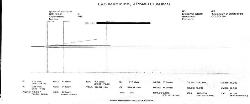 https://cdn.ncbi.nlm.nih.gov/pmc/blobs/1925/7723805/1bba92aceaf3/gr4.jpg