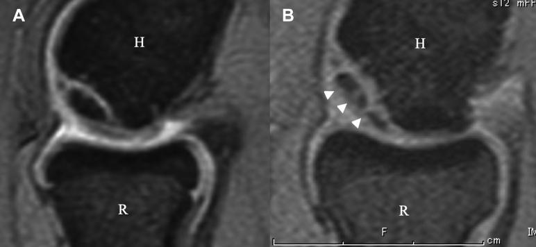 https://cdn.ncbi.nlm.nih.gov/pmc/blobs/1931/8178622/65d54e56dc58/gr4.jpg