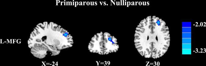 https://cdn.ncbi.nlm.nih.gov/pmc/blobs/1933/9444322/7a71b90cfb56/fnagi-14-963943-g003.jpg
