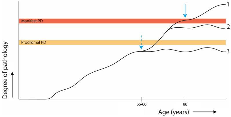 https://cdn.ncbi.nlm.nih.gov/pmc/blobs/1934/11048137/6b22d8780753/brainsci-14-00358-g001.jpg