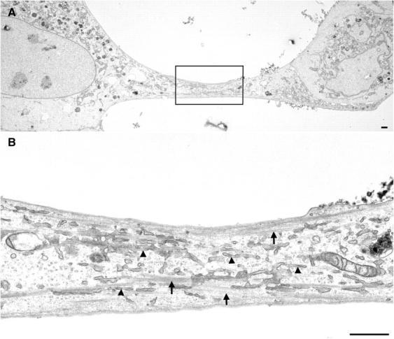 https://cdn.ncbi.nlm.nih.gov/pmc/blobs/1939/2172404/aaada4cfd292/200311054f6.jpg