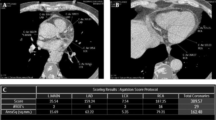 https://cdn.ncbi.nlm.nih.gov/pmc/blobs/1946/3955514/4e8cfcf90e26/ircmj-15-16616-g002.jpg