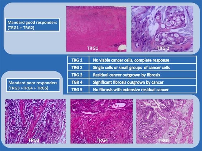 https://cdn.ncbi.nlm.nih.gov/pmc/blobs/1947/5601639/334b18f9b064/oncotarget-08-58133-g003.jpg