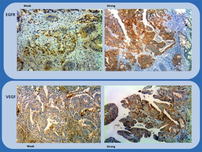 https://cdn.ncbi.nlm.nih.gov/pmc/blobs/1947/5601639/bfcc2ab178c5/oncotarget-08-58133-g002.jpg