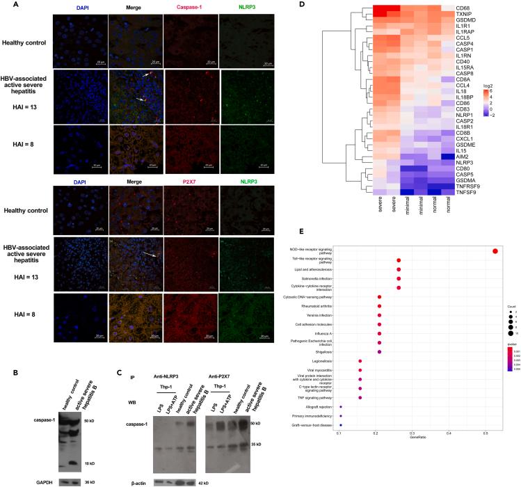https://cdn.ncbi.nlm.nih.gov/pmc/blobs/1957/10819783/b1ca6e928515/gr4.jpg