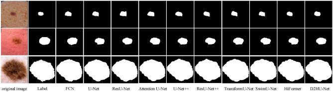 https://cdn.ncbi.nlm.nih.gov/pmc/blobs/1962/11894187/298802f62f39/41598_2025_92715_Fig5_HTML.jpg