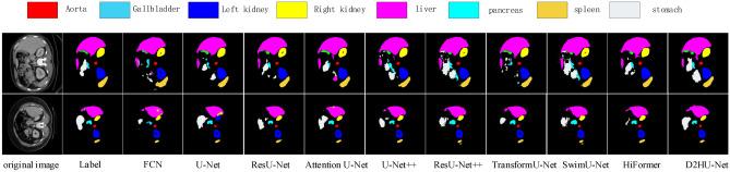 https://cdn.ncbi.nlm.nih.gov/pmc/blobs/1962/11894187/86f43d8665c1/41598_2025_92715_Fig4_HTML.jpg