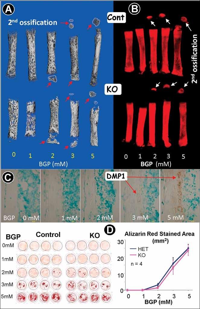 https://cdn.ncbi.nlm.nih.gov/pmc/blobs/1967/3179305/1b0913ddd199/jbmr0026-1047-f3.jpg