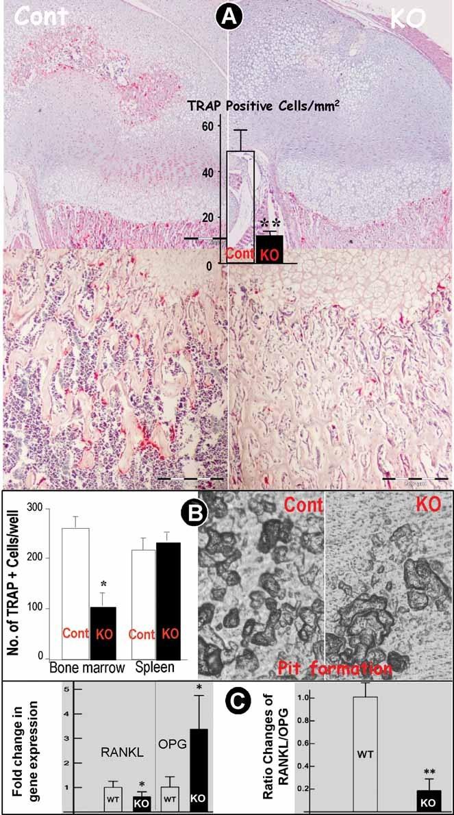 https://cdn.ncbi.nlm.nih.gov/pmc/blobs/1967/3179305/30e93d0dc5bc/jbmr0026-1047-f2.jpg