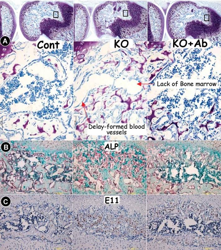 https://cdn.ncbi.nlm.nih.gov/pmc/blobs/1967/3179305/65b701726577/jbmr0026-1047-f5.jpg