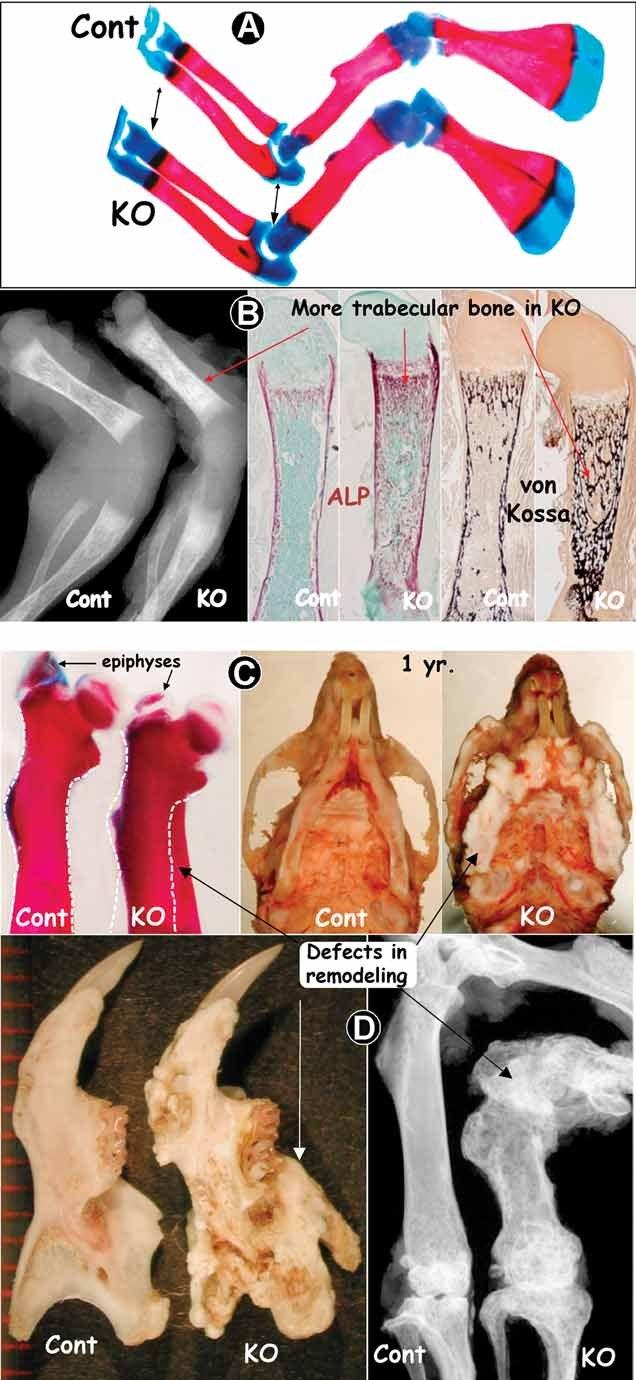 https://cdn.ncbi.nlm.nih.gov/pmc/blobs/1967/3179305/980ba30e6b90/jbmr0026-1047-f1.jpg