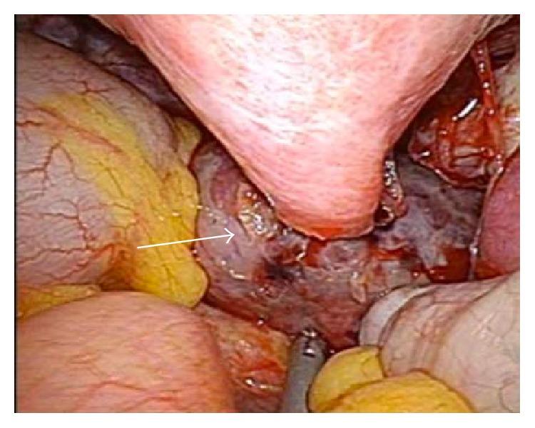 https://cdn.ncbi.nlm.nih.gov/pmc/blobs/196a/4808536/21282cbefcfa/CRIOG2016-7831270.004.jpg