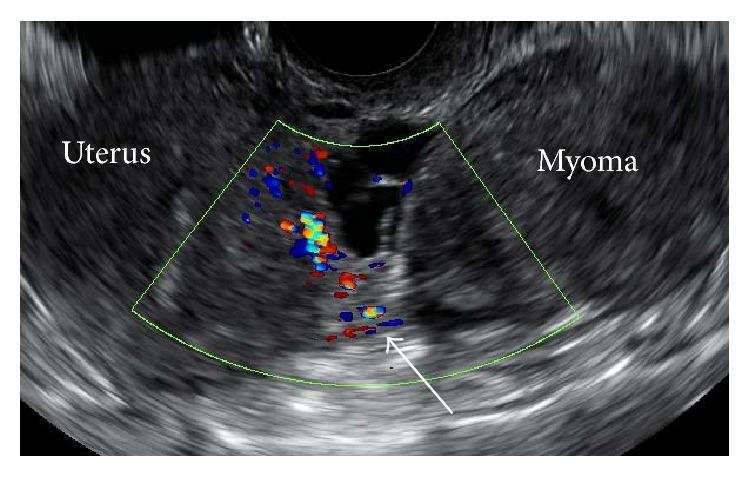 https://cdn.ncbi.nlm.nih.gov/pmc/blobs/196a/4808536/fbf877058919/CRIOG2016-7831270.001.jpg