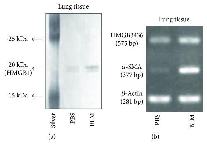 https://cdn.ncbi.nlm.nih.gov/pmc/blobs/196b/5924979/f49284c427f1/OMCL2018-8249693.004.jpg