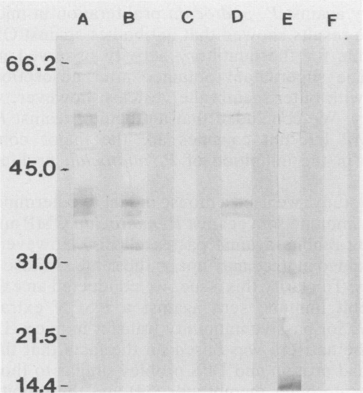 https://cdn.ncbi.nlm.nih.gov/pmc/blobs/1971/257865/9baa64adf81a/iai00040-0267-a.jpg