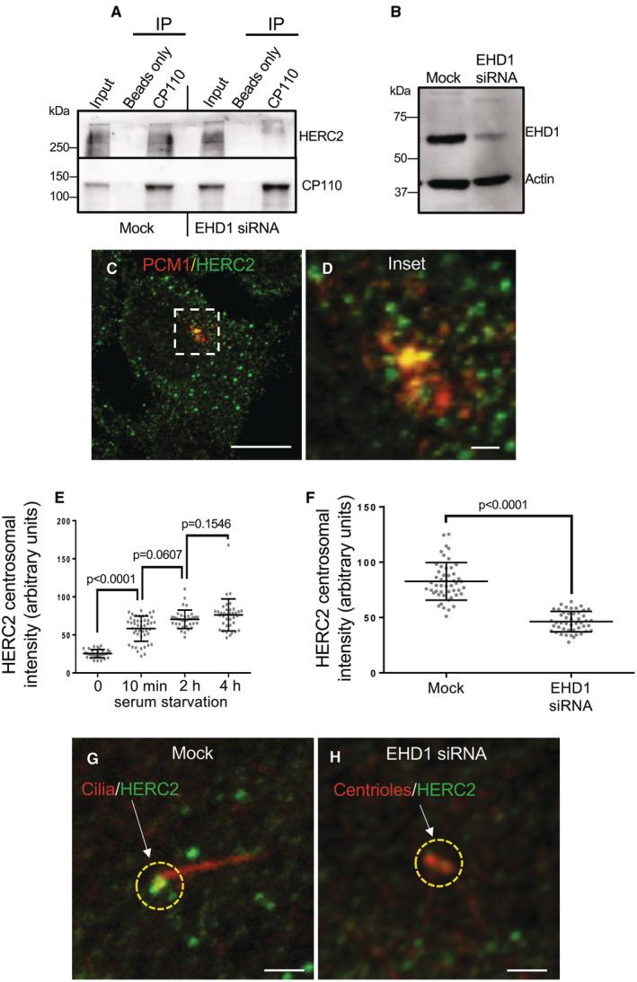 https://cdn.ncbi.nlm.nih.gov/pmc/blobs/1972/10240189/21681231a696/EMBR-24-e56317-g002.jpg