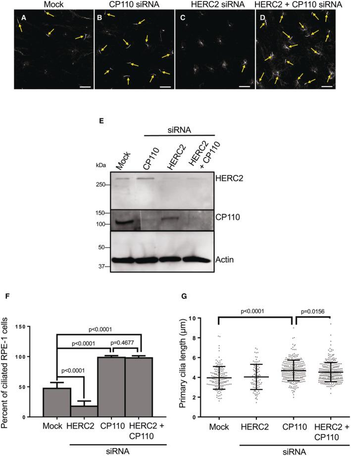 https://cdn.ncbi.nlm.nih.gov/pmc/blobs/1972/10240189/a80a5f0ca8f5/EMBR-24-e56317-g011.jpg
