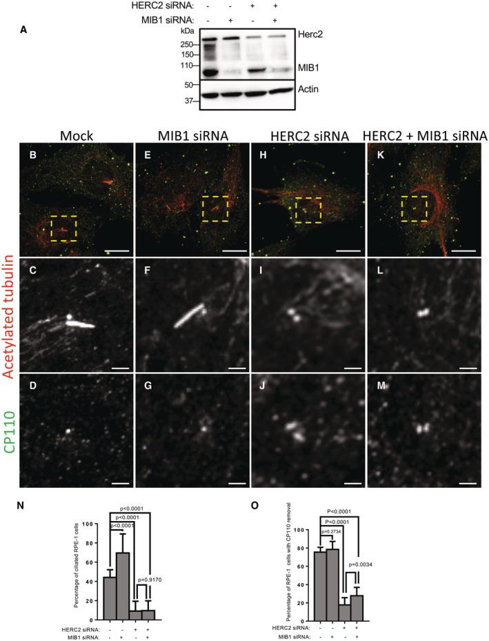 https://cdn.ncbi.nlm.nih.gov/pmc/blobs/1972/10240189/c18f238b1c8a/EMBR-24-e56317-g003.jpg