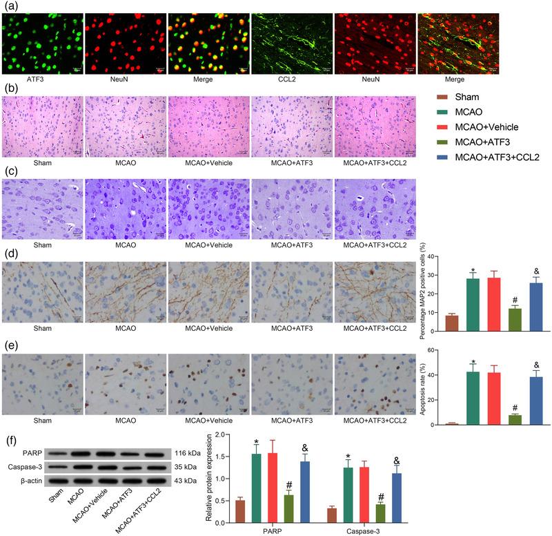 https://cdn.ncbi.nlm.nih.gov/pmc/blobs/1973/9014992/135ed7652f51/BRB3-12-e2522-g006.jpg