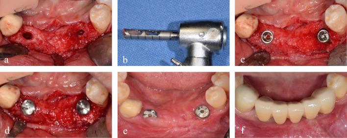 https://cdn.ncbi.nlm.nih.gov/pmc/blobs/1974/10980665/d0a1af635ed4/40729_2024_535_Fig4_HTML.jpg
