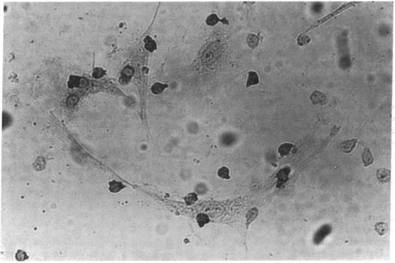 https://cdn.ncbi.nlm.nih.gov/pmc/blobs/1977/424563/19db8a9326d3/jcinvest00128-0203-a.jpg